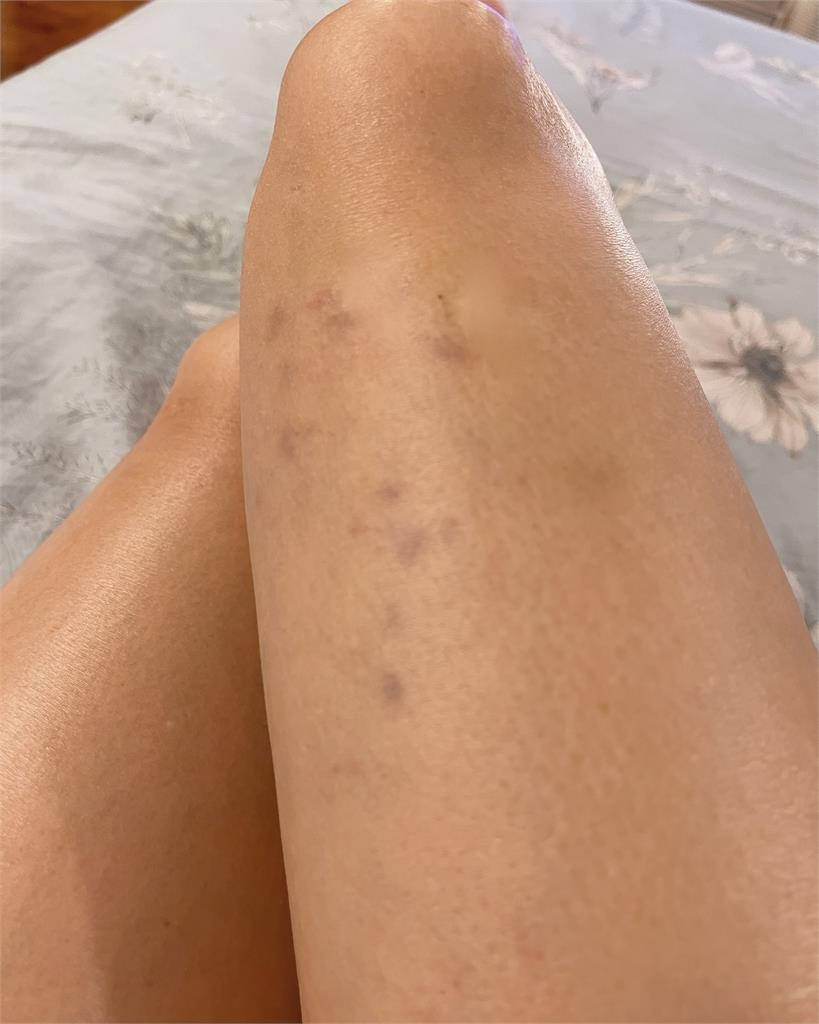 58歲絕頂美魔女「自曝被打到瘀青」!13秒遭動手畫面流出…網急關切