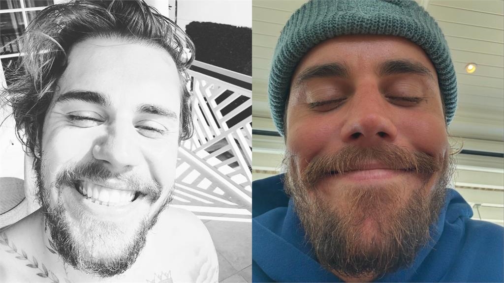 海邊脫光「野人大叔」竟是小賈斯汀!30歲真面目「慘變50歲」網嚇:本人嗎?