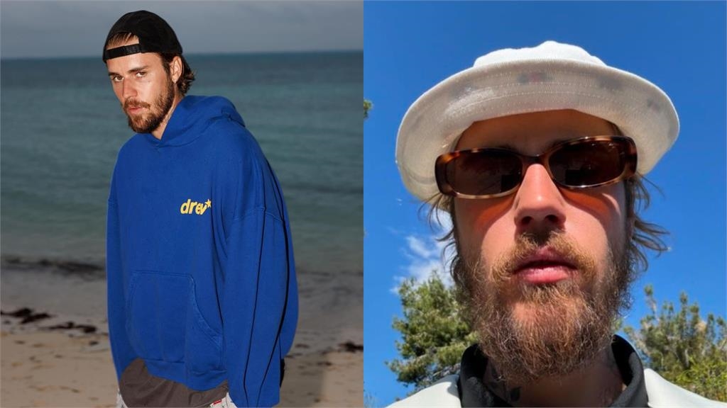 海邊脫光「野人大叔」竟是小賈斯汀!30歲真面目「慘變50歲」網嚇:本人嗎?