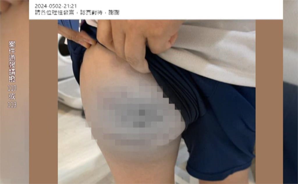 北市國小爆體罰 羽球隊教練處罰8童「屁股大塊瘀青」