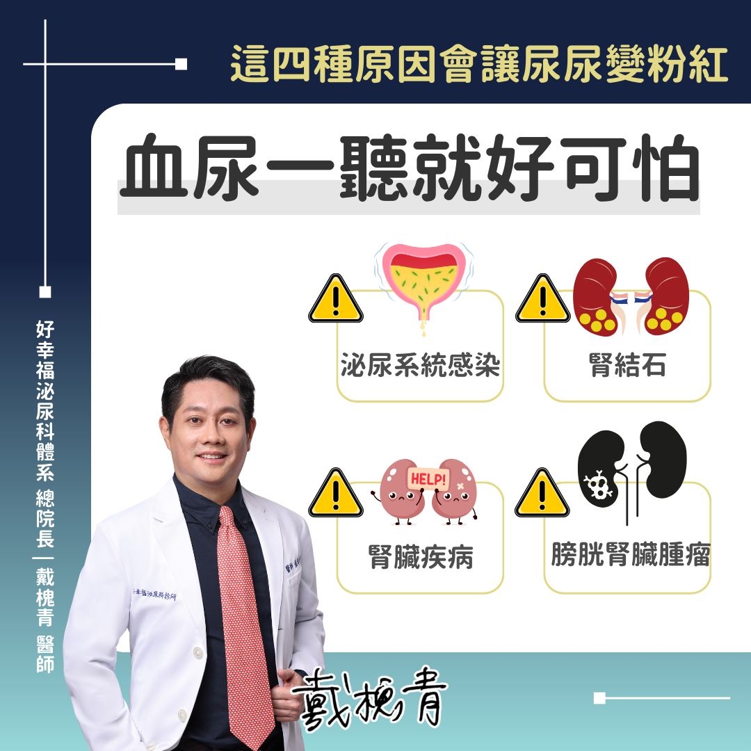 血尿＝重病？醫曝4大成因　「這情況」需快就醫