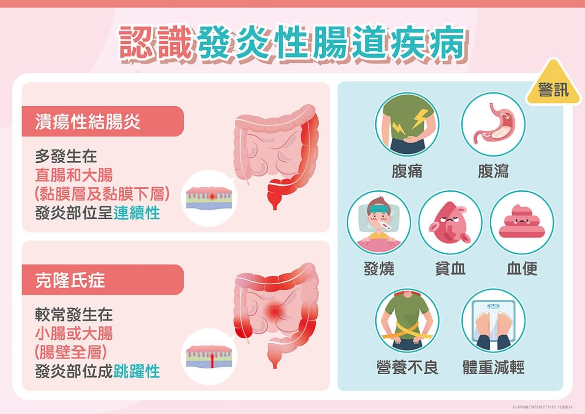 反覆腹痛腹瀉好「炎」重！醫揭密發炎性腸道疾病治療關鍵