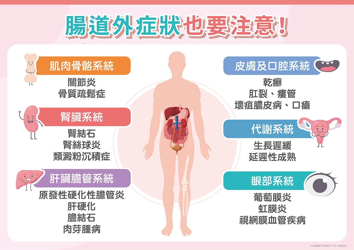 反覆腹痛腹瀉好「炎」重！醫揭密發炎性腸道疾病治療關鍵