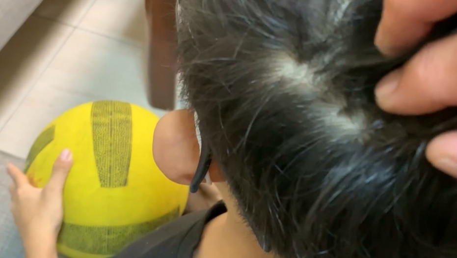 男童打球致腦震盪　體育師寫聯絡簿「學生沒躲好」遭質疑卸責