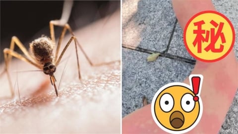 密集恐懼慎入！妹子曬被「小黑蚊狂叮129包」腿照　吸引2.3萬網友朝聖：看到我都癢了