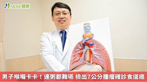 男子喉嚨卡卡!連粥都難嚥 檢出7公分腫瘤確診食道癌