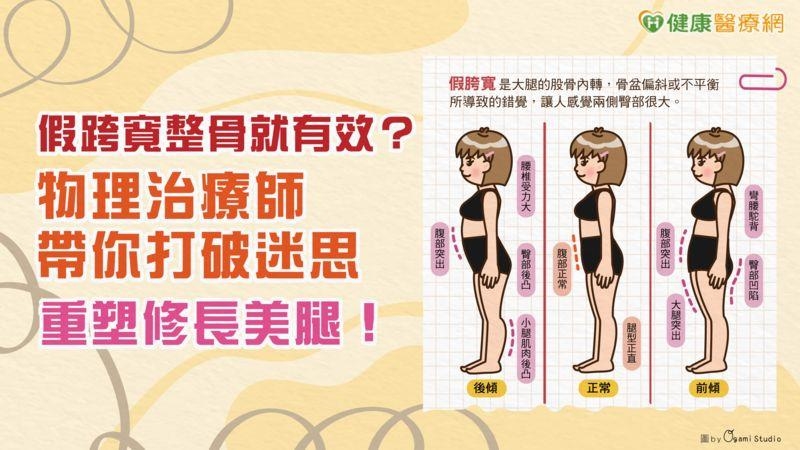 假跨寬整骨就有效?物理治療師帶你打破迷思 重塑修長美腿! 假跨寬整骨就有效?物理治療師帶你打破迷思 重塑修長美腿!