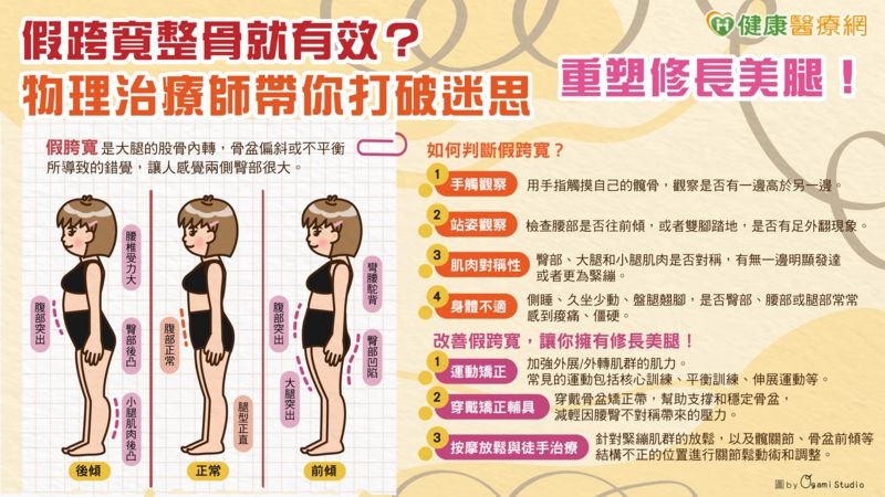 假跨寬整骨就有效?物理治療師帶你打破迷思 重塑修長美腿!