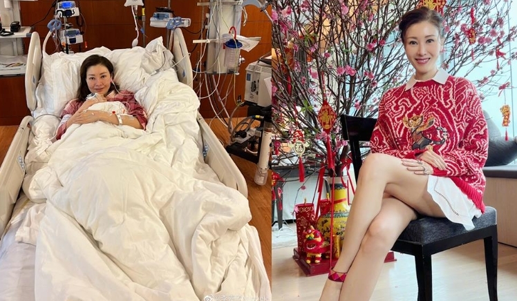 54歲李嘉欣凍齡全靠P圖？手臂「修圖超明顯」網見青筋傻了：怪怪的