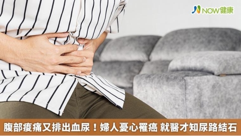 腹部痠痛又排出血尿!婦人憂心罹癌 就醫才知尿路結石