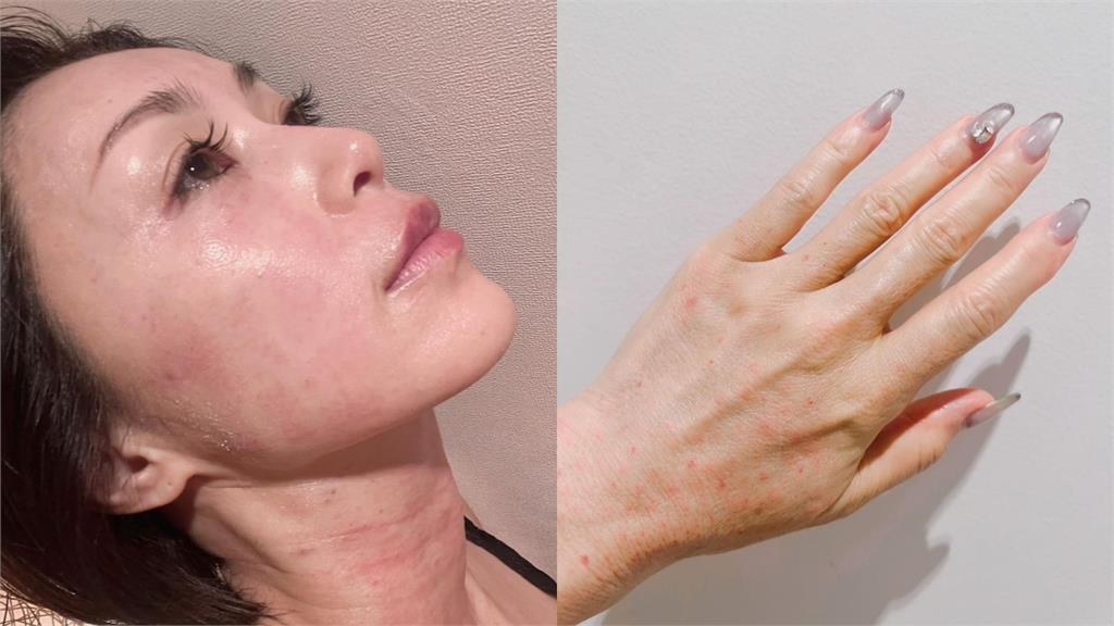 「擋泥板女神」酒井法子怎麼了?53歲真面目大變形…網嚇爛:挑戰太大