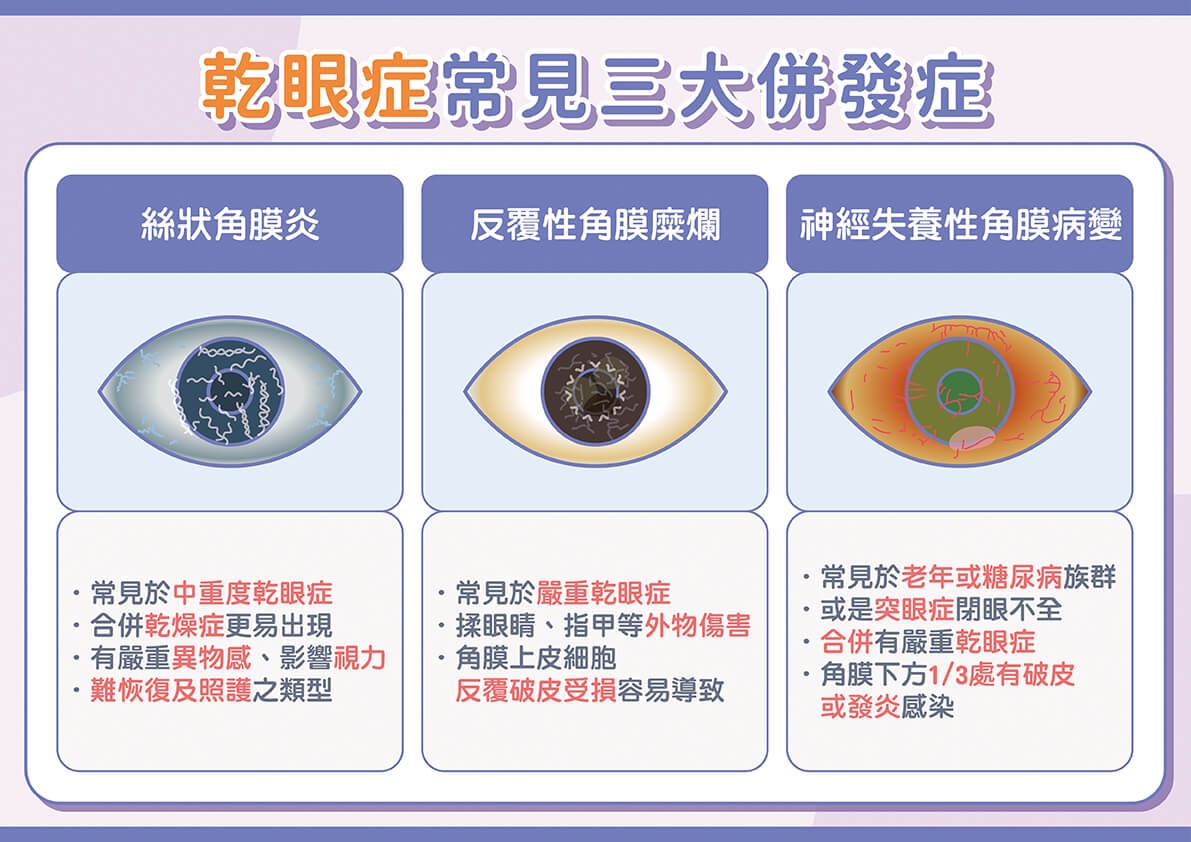 現代3C族必看！忽視乾眼症當心三大併發症找上！