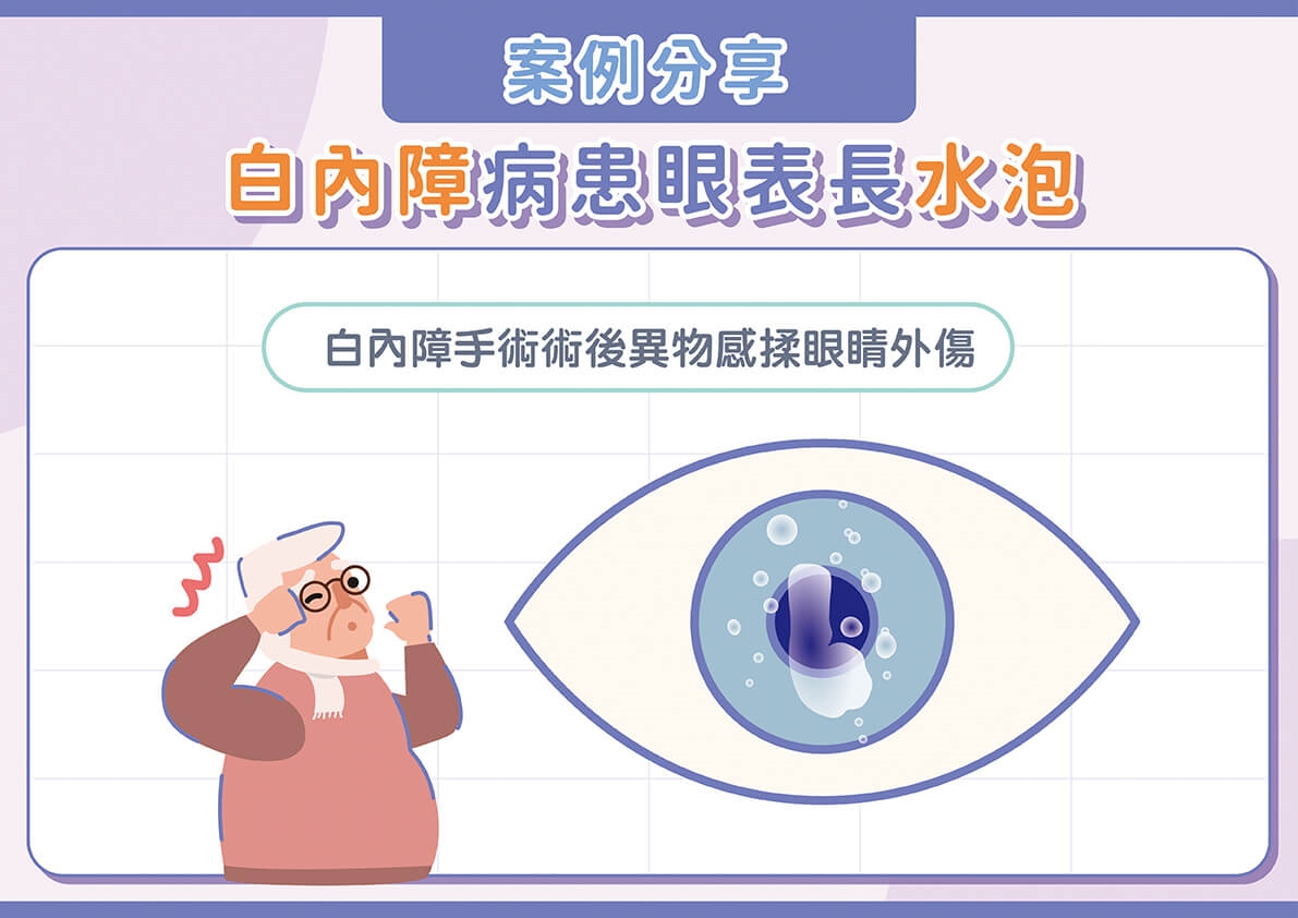 現代3C族必看！忽視乾眼症當心三大併發症找上！