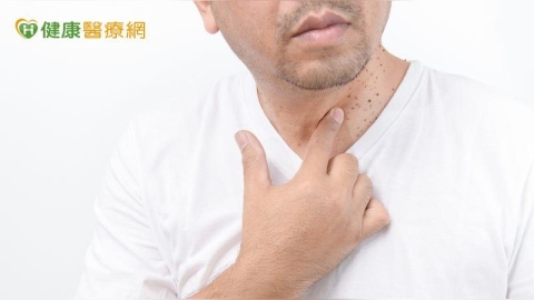 AI智慧新助益!圈註技術有效增加放療精準度 癌症病人有效續命