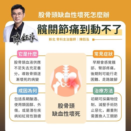 喝酒會「蛀掉」骨頭！醫揭股骨頭壞死成因　早期症狀1個動作就知道