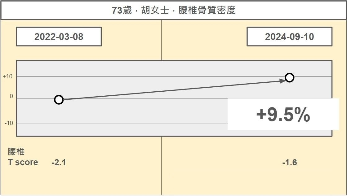 亞東醫院整合AI檢測骨質疏鬆！ 提供骨鬆患者全面照顧