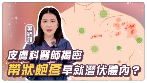 皮膚又痛又癢長水泡　恐遭「帶狀疱疹」纏身？提升保護力「這年齡族群」可施打疫苗