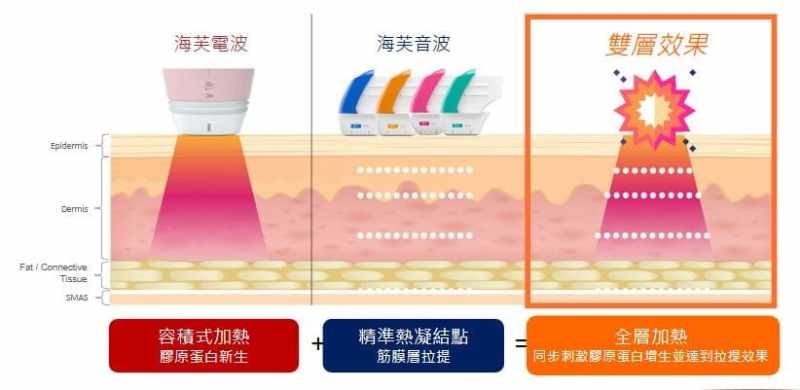 「海芙電音雙波」雙效合一　達到全層抗衰效果