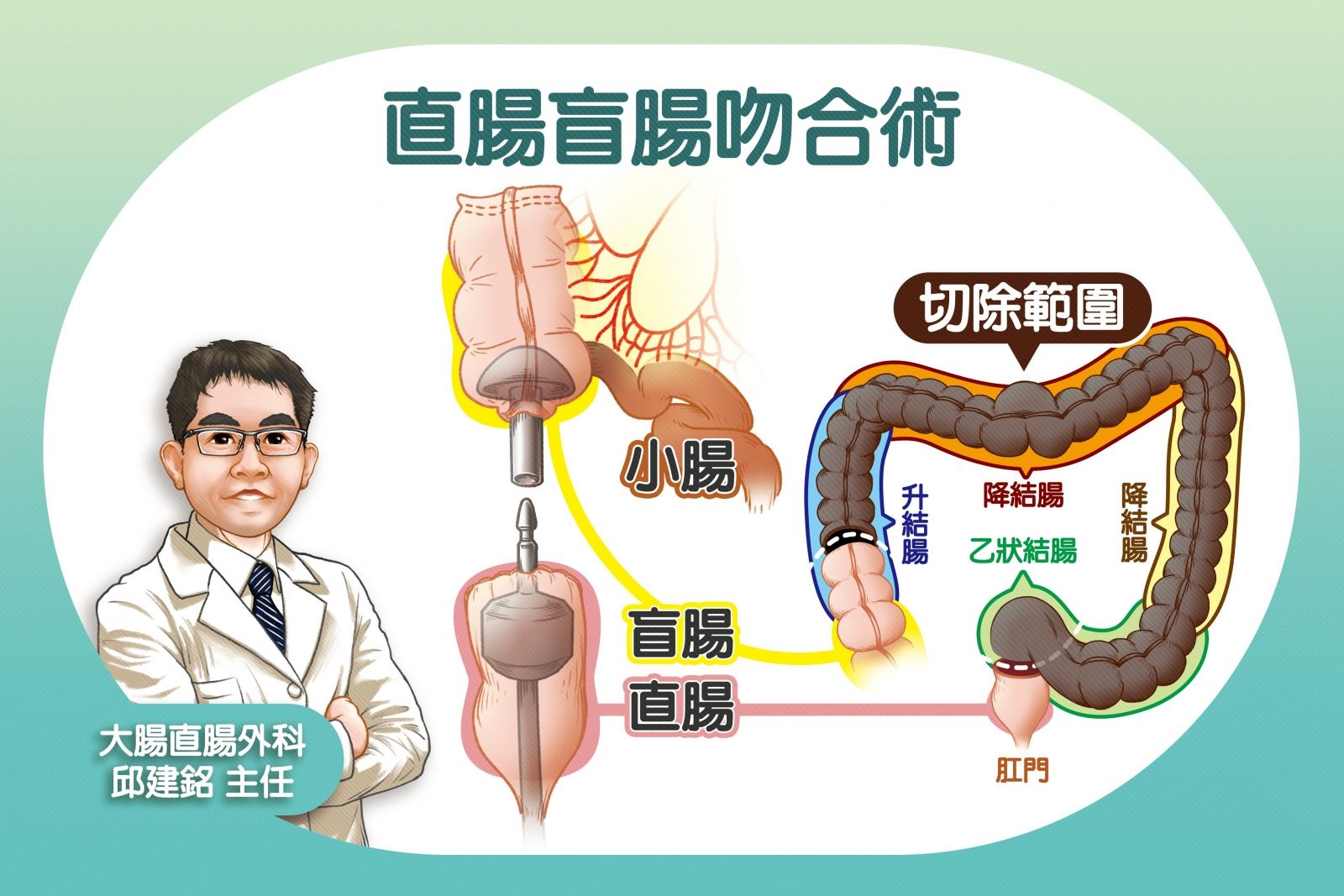 錯誤瘦身導致腸道失能！ 醫同時解決身心問題根除病灶 