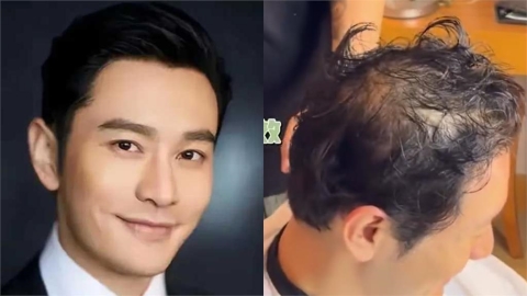 黃曉明傳被葉珂討12億分手費！一件事慘成「禿頭大叔」認：假髮要戴半年