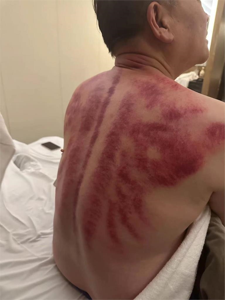 澎恰恰進軍中國怨「台灣把我當瘟神」!赴中拍戲「慘照遭外流」整片紫紅