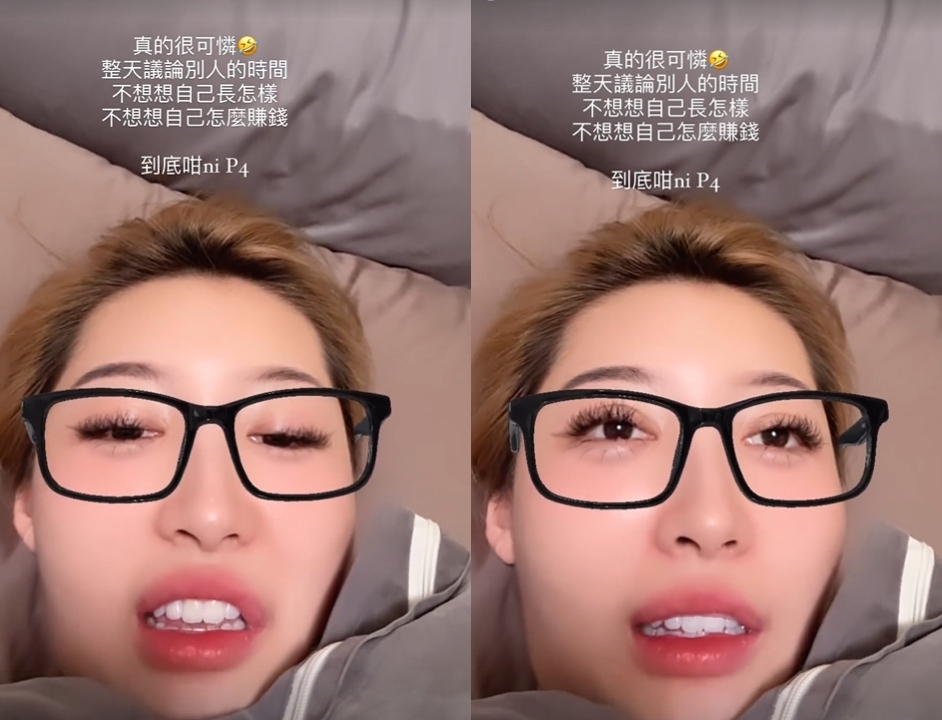 趙露思「臉蛋進化」瘋傳整型！鳳梨辣妻「拍片揪1變化」飆粗開嗆：可憐