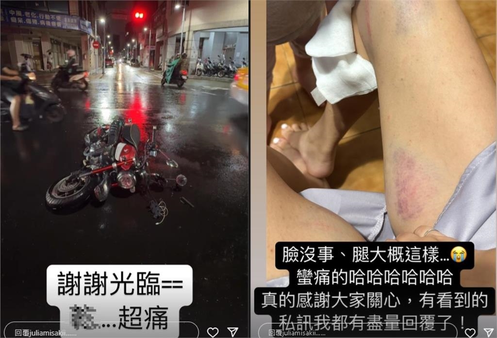 台中高鐵「長髮嫩妹」是重機女神！車禍後1個月近況震撼網：是不是有點…