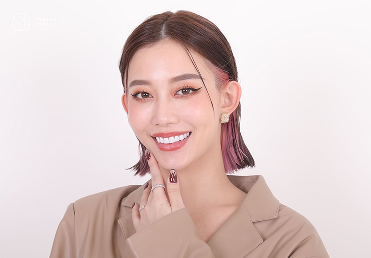 陶瓷貼片打造專屬微笑曲線 符合3條件、4種型態任你選