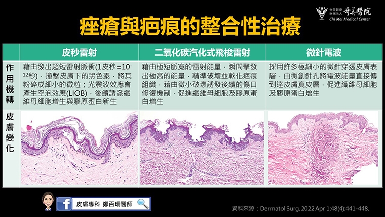 青春痘長大就會好?男大生聽信長輩建言 滿臉痤瘡痘疤