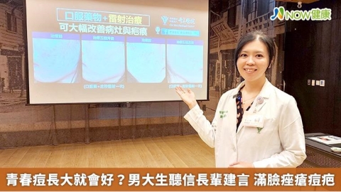 青春痘長大就會好？男大生聽信長輩建言 滿臉痤瘡痘疤