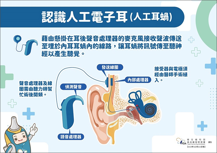 人工電子耳助重度聽損者聽見聲音! 3類適用族群1次看