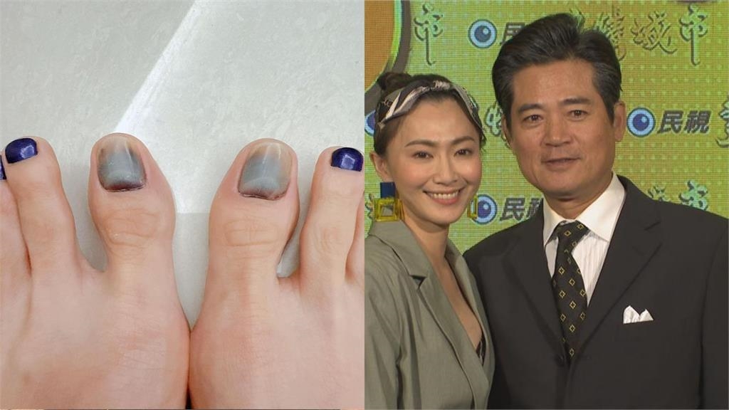 侯怡君為拍戲「吃地上髒麵+腳指甲黑掉」!點名1人「不願拍他的戲」