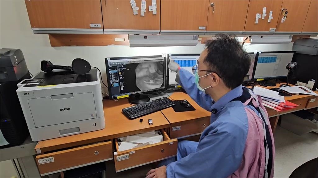 基隆80歲翁誤食魚骨掛急診 大腸積滿「鮮血、黑便」