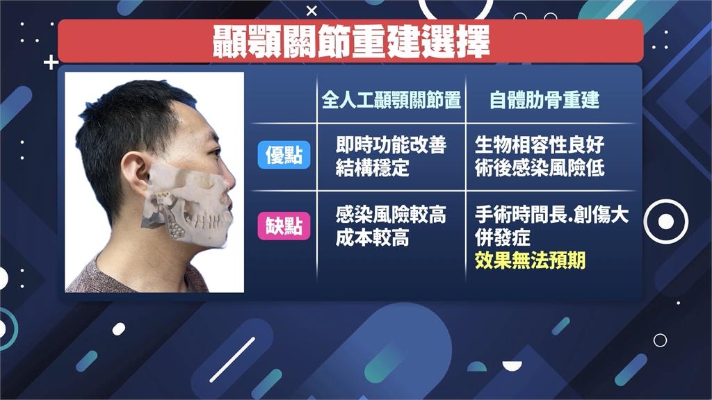 男車禍顏面變形2年難進食.說話 「全人工關節置換」助恢復