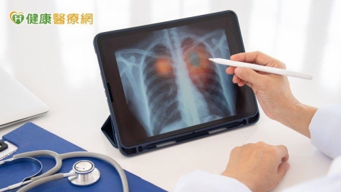 晚期肺癌治療現曙光 最新健保給付標靶藥物 不限腦轉移