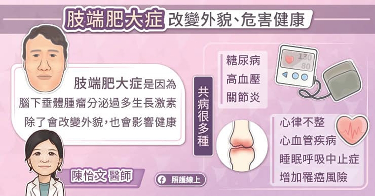 口罩藏異容! 婦人下顎突出、鼻翼變寬竟罹肢端肥大症