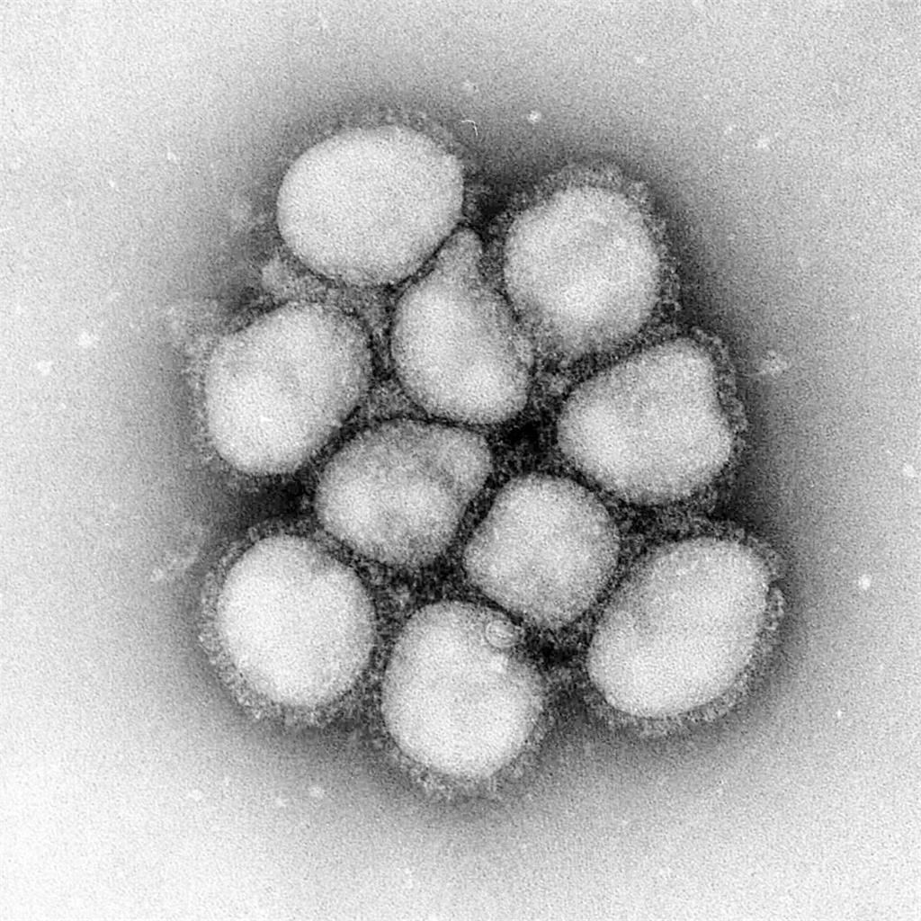 飛日確診流感血噴7000元「旅平險恐不賠」！達人教1招：100％都理賠