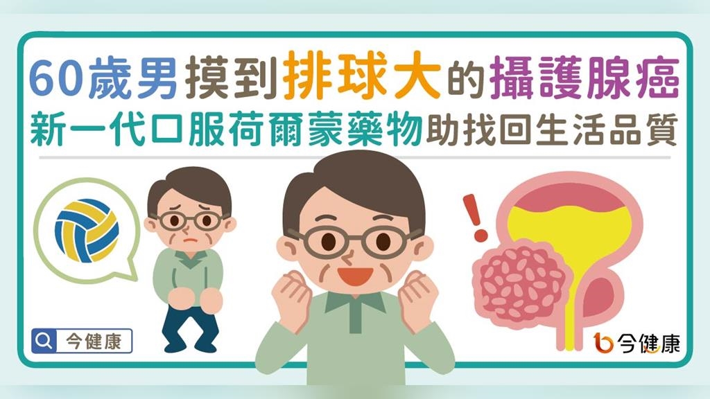 60歲男摸到排球大的攝護腺癌！新一代口服荷爾蒙治療藥物助他找回生活品質