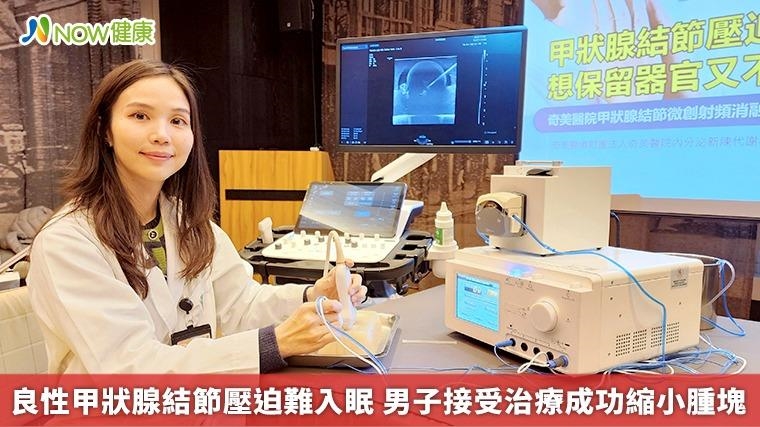良性甲狀腺結節壓迫難入眠 男子接受治療成功縮小腫塊 良性甲狀腺結節壓迫難入眠 男子接受治療成功縮小腫塊