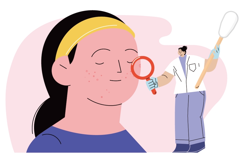 正確用藥，一起擺脫痘痘困擾