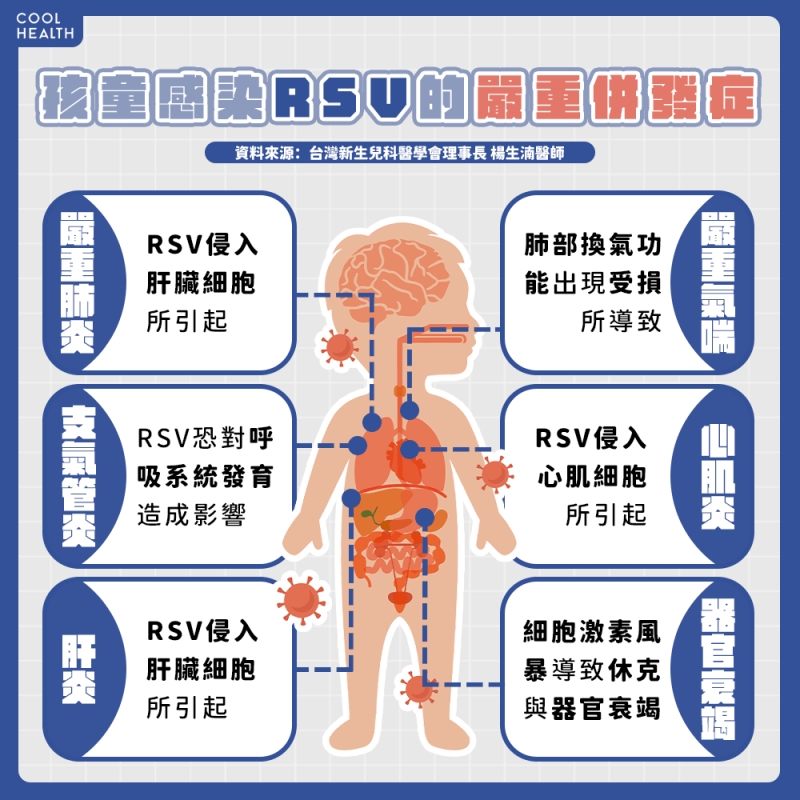 RSV不只是「嚴重一點的感冒」！ 醫：將持續影響孩童呼吸系統