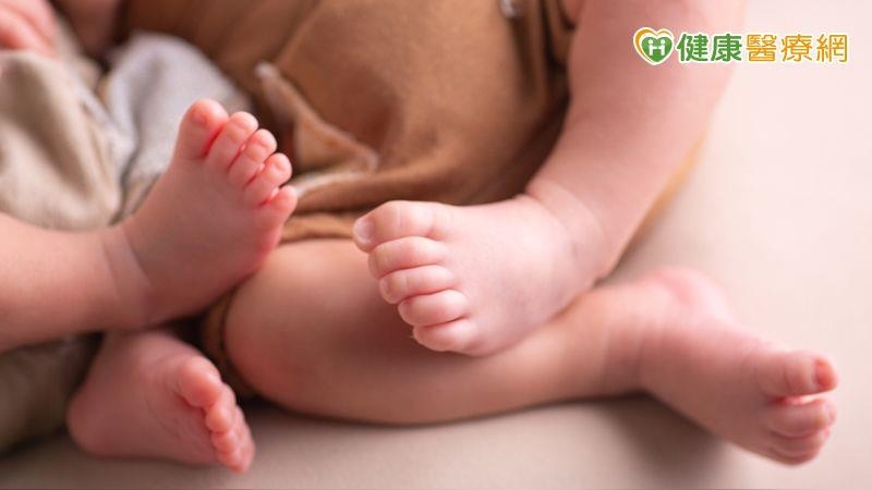早產龍鳳雙胞胎女嬰「腹股溝疝氣」　微創手術成功修補