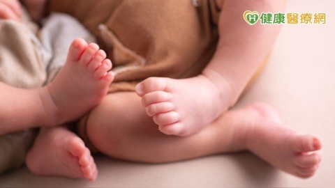 早產龍鳳雙胞胎女嬰「腹股溝疝氣」 微創手術成功修補