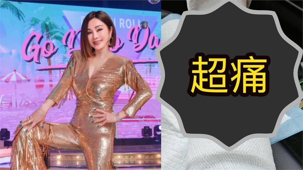 美魔女陳美鳳「受傷送醫」畫面流出！本尊曝「最新傷勢」認做錯1事