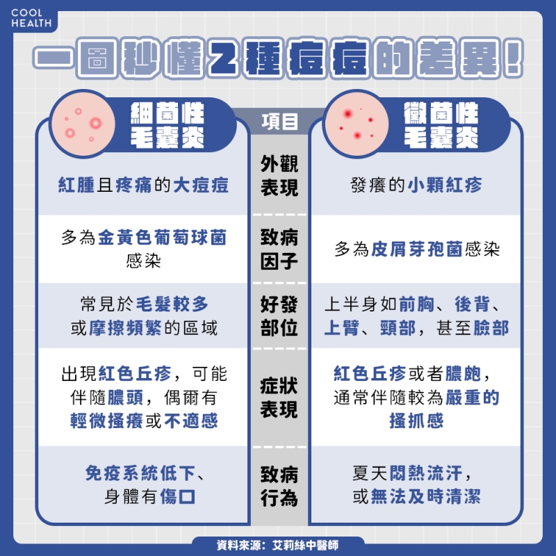 肌肉還沒長臉先爛一片! 喝高蛋白爆痘怎麼辦?