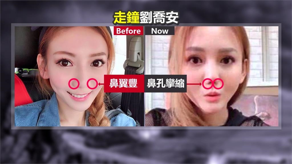 劉喬安涉毒等罪被通緝在美落網 昔吸毒走鐘「鼻腔全空」悔:連醫生都難救!