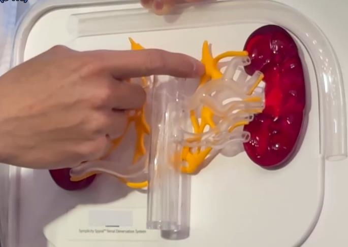 「隱性高血壓」作怪！　壯年男臉潮紅、身體燥熱