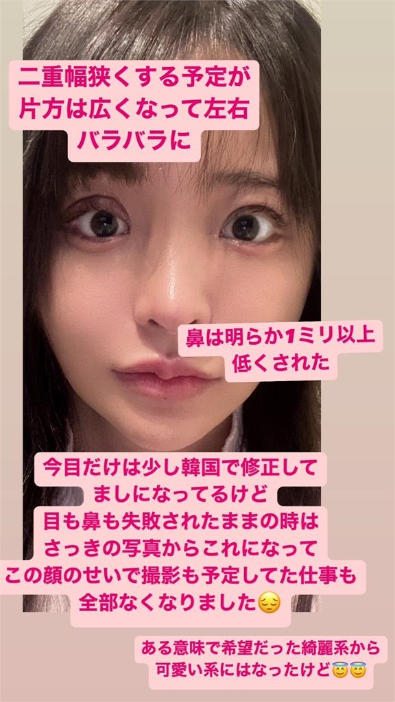 日本動作女星宣布不幹了！全因整型失敗「3眼皮慘況曝」損失破220萬