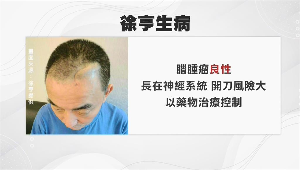 欠債不拖累家人!徐亨爆「罹患腦瘤」腦動刀 已淨身出戶離婚