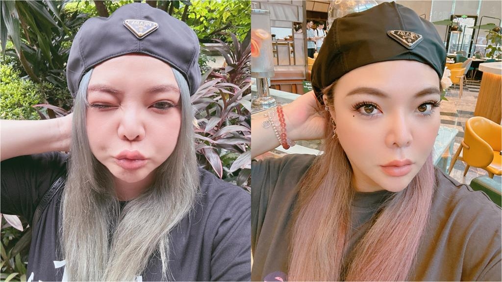 小甜甜赴中國8個月「健康亮紅燈」痛到快站不起來!急吐人生唯一希望